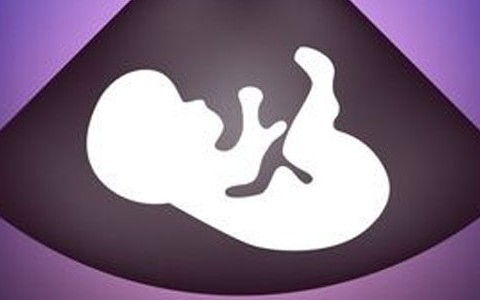 Surrogacy an ancient practice