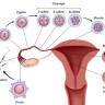 ICSI procedure