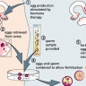 Stages of IVF procedure