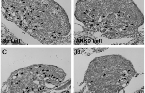Male hormone plays key role in ovarian development