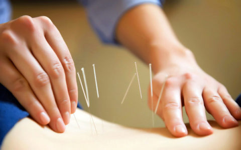 Acupuncture may not be effective in treating infertility
