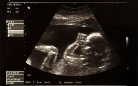 5 amazing things preborn children can do inside the womb