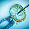 Statistically, 1,5% of American children born by means of IVF procedure