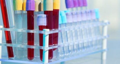 A MATERNAL BLOOD TEST COULD PREDICT PROBLEMS AT BIRTH