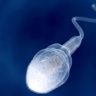 How does sperm motility affect fertility?