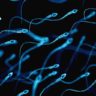 Taurine deficiency in sperm causes male infertility