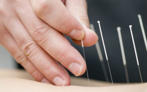 Fertility study finds acupuncture ineffective for IVF birth rates