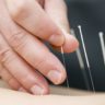 Fertility study finds acupuncture ineffective for IVF birth rates